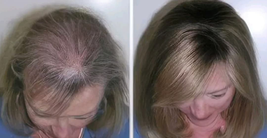 Beautiful caucasian woman with before and after photos of hair replacement